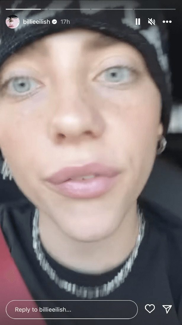 As she rides in her car, Billie Eilish shows off her natural beauty ...