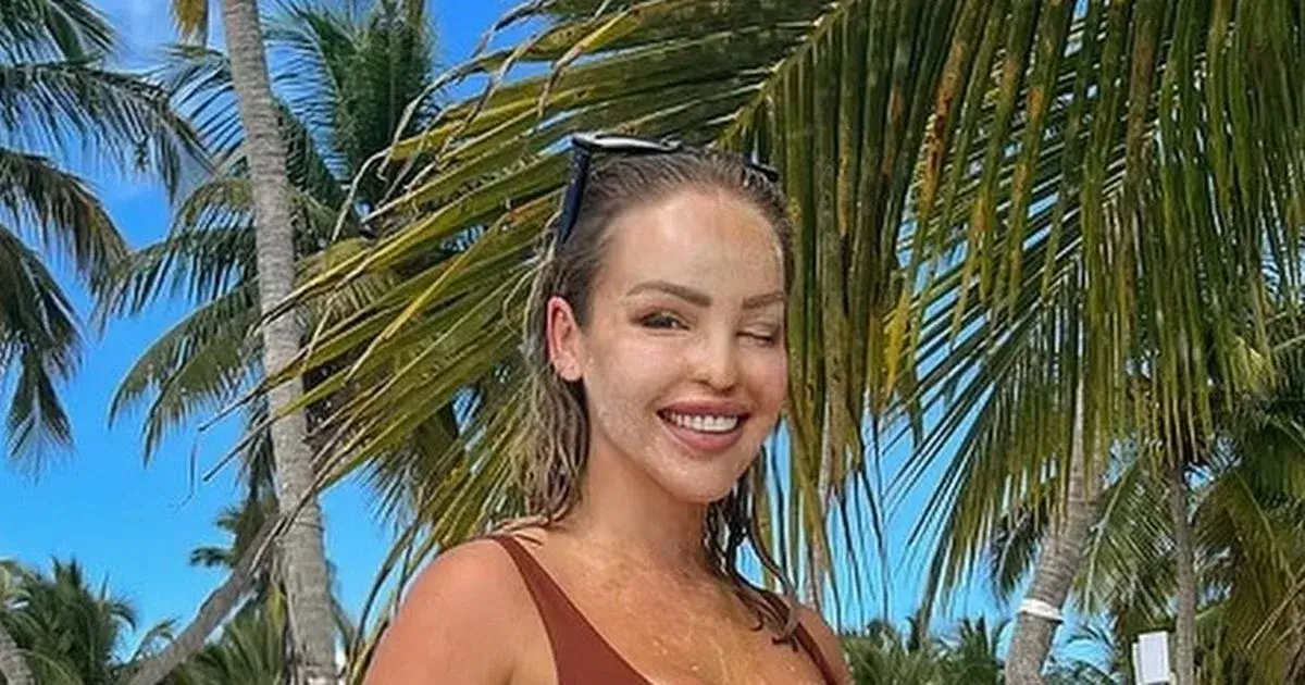 On her beach vacation, Katie Piper shows off her killer curves in a teeny brown bikini while being hailed as ‘radiant’